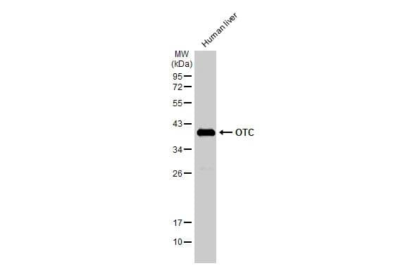 Western Blot Ornithine Carbamoyltransferase Antibody - BSA Free