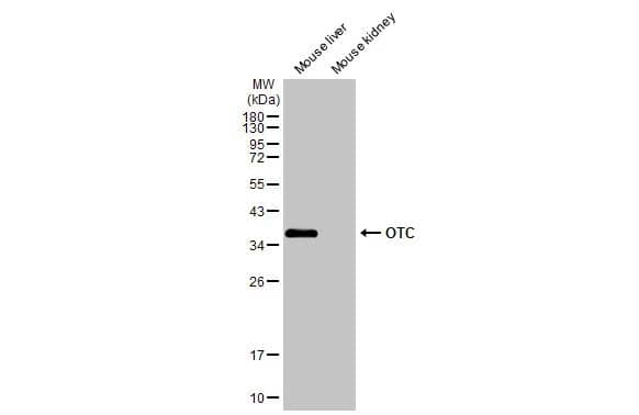 Western Blot Ornithine Carbamoyltransferase Antibody - BSA Free