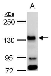 Bub1 antibody detects Bub1 protein by western blot analysis.A. 30 ug 293T whole cell lysate/extract5 % SDS-PAGEBub1 antibody (NBP1-31584) dilution: 1:1000 