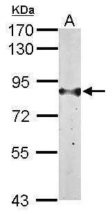 Sample (50 ug of whole cell lysate)  A: Mouse liver  7.5% SDS PAGE  NBP1-31588 diluted at 1:1000  