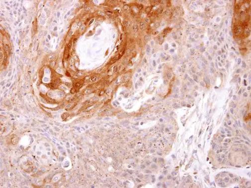 Immunohistochemistry Prostasin/Prss8 Antibody - BSA Free