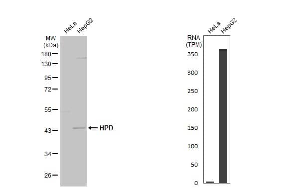 <b>Orthogonal Strategies Validation. </b>Western Blot: HPD Antibody [NBP1-31593] - Various whole cell extracts (30 ug) were separated by 10% SDS-PAGE, and the membrane was blotted with HPD antibody [N1C2]  diluted at 1:3000. The HRP-conjugated anti-rabbit IgG antibody  was used to detect the primary antibody. Corresponding RNA expression data for the same cell lines are based on Human Protein Atlas program.