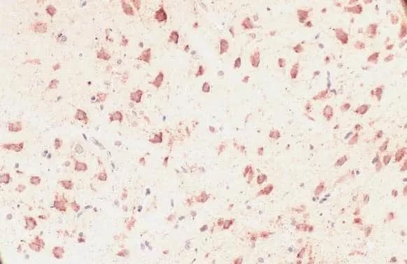 Immunohistochemistry-Paraffin: GRP75/HSPA9B/Mortalin Antibody [NBP1-31596] - GRP75/HSPA9B/Mortalin antibody detects GRP75/HSPA9B/Mortalin protein at cytoplasm by immunohistochemical analysis.Sample: Paraffin-embedded rat brain.GRP75/HSPA9B/Mortalin stained by GRP75/HSPA9B/Mortalin antibody (NBP1-31596) diluted at 1:500.Antigen Retrieval: Citrate buffer, pH 6.0, 15 min