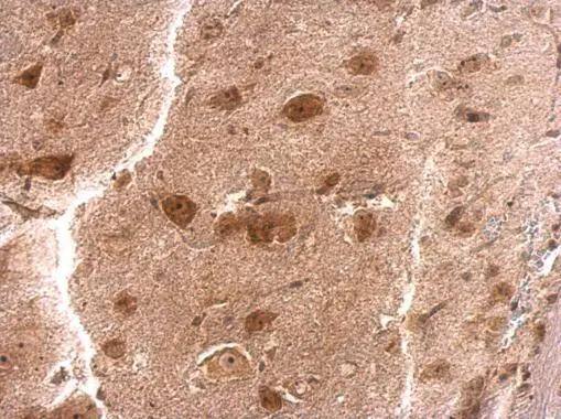 RPS3A antibody detects RPS3A protein at cytosol on mouse brain stem by immunohistochemical analysis. Sample: Paraffin-embedded mouse brain stem. RPS3A antibody (NBP1-31598) dilution: 1:200. Antigen Retrieval: (EDTA based, pH 8.0) buffer, 15min 