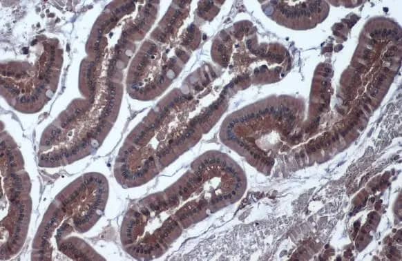 Immunohistochemistry-Paraffin: Isocitrate Dehydrogenase 1/IDH1 Antibody [NBP1-31599] - Isocitrate Dehydrogenase 1/IDH1 antibody detects Isocitrate Dehydrogenase 1/IDH1 protein at cytoplasm by immunohistochemical analysis.Sample: Paraffin-embedded rat duodenum.Isocitrate Dehydrogenase 1/IDH1 stained by Isocitrate Dehydrogenase 1/IDH1 antibody (NBP1-31599) diluted at 1:1000.Antigen Retrieval: Citrate buffer, pH 6.0, 15 min