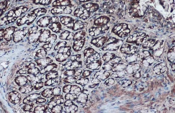 Immunohistochemistry-Paraffin: Isocitrate Dehydrogenase 1/IDH1 Antibody [NBP1-31599] - Isocitrate Dehydrogenase 1/IDH1 antibody detects Isocitrate Dehydrogenase 1/IDH1 protein at cytoplasm by immunohistochemical analysis.Sample: Paraffin-embedded rat colon.Isocitrate Dehydrogenase 1/IDH1 stained by Isocitrate Dehydrogenase 1/IDH1 antibody (NBP1-31599) diluted at 1:1000.Antigen Retrieval: Citrate buffer, pH 6.0, 15 min