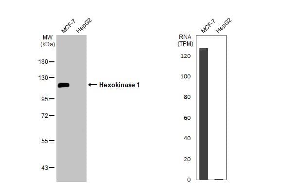 <b>Orthogonal Strategies Validation. </b>Western Blot: Hexokinase 1 Antibody [NBP1-31600] - Various whole cell extracts (30 ug) were separated by 7.5% SDS-PAGE, and the membrane was blotted with Hexokinase 1 antibody  diluted at 1:3000. The HRP-conjugated anti-rabbit IgG antibody  was used to detect the primary antibody. Corresponding RNA expression data for the same cell lines are based on Human Protein Atlas program.