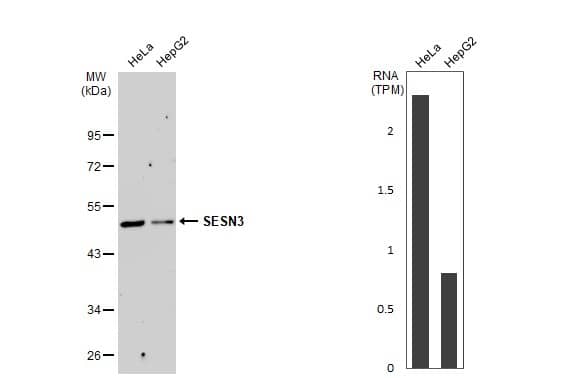 Western Blot: SESN3 Antibody [NBP1-31702] - Various whole cell extracts (30 ug) were separated by 10% SDS-PAGE, and the membrane was blotted with SESN3 antibody  diluted at 1:1000. The HRP-conjugated anti-rabbit IgG antibody  was used to detect the primary antibody, and the signal was developed with Trident ECL plus-Enhanced.