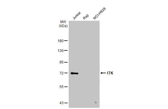 Various whole cell extracts (30 ug) were separated by 7.5% SDS-PAGE, and the membrane was blotted with ITK antibody [N2C1], Internal (NBP1-31732) diluted at 1:1000. The HRP-conjugated anti-rabbit IgG antibody was used to detect the primary antibody. 