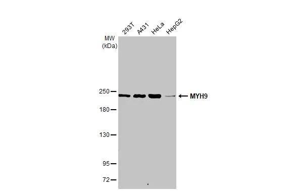 Various whole cell extracts (30 ug) were separated by 5% SDS-PAGE, and the membrane was blotted with non-muscle Myosin IIA antibody [N1-2], N-term (NBP1-31733) diluted at 1:500. The HRP-conjugated anti-rabbit IgG antibody was used to detect the primary antibody. 