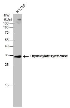 Western Blot: Thromboxane synthase Antibody [NBP1-31739] - Whole cell extract (30 ug) was separated by 12% SDS-PAGE, and the membrane was blotted with Thymidylate synthetase antibody [N3C3] (NBP1-31739) diluted at 1:1000.