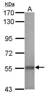 Western Blot: ALDH2 Antibody [NBP1-31749] - Sample (30 ug of whole cell lysate)  A: whole zebrafish  7.5% SDS PAGE  NBP1-31749 diluted at 1:1000 