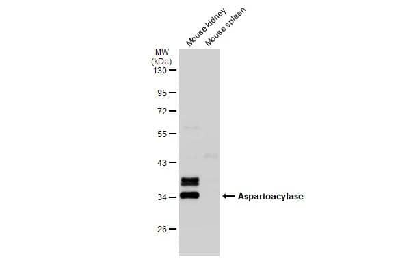 Various tissue extracts (50 ug) were separated by 10% SDS-PAGE, and the membrane was blotted with ASPA antibody [N1C3-2] (NBP1-31754) diluted at 1:1000. The HRP-conjugated anti-rabbit IgG antibody was used to detect the primary antibody. 