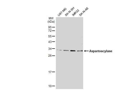 Various whole cell extracts (30 ug) were separated by 12% SDS-PAGE, and the membrane was blotted with ASPA antibody [N1C3-2] (NBP1-31754) diluted at 1:1000. The HRP-conjugated anti-rabbit IgG antibody was used to detect the primary antibody. 