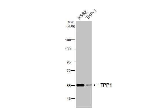 Various whole cell extracts (30 ug) were separated by 7.5% SDS-PAGE, and the membrane was blotted with Tripeptidyl-Peptidase I/TPP1 antibody [N1C1] (NBP1-31758) diluted at 1:1000. The HRP-conjugated anti-rabbit IgG antibody was used to detect the primary antibody. 