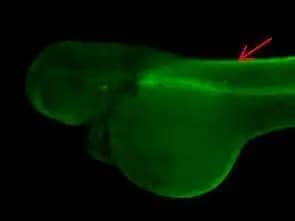 Immunohistochemistry: ENO3 Antibody [NBP1-31764] - Immunohistochemical analysis (whole mount) of zebrafish embryo, using ENO3 antibody (NBP1-31764) at 1:200 dilution.