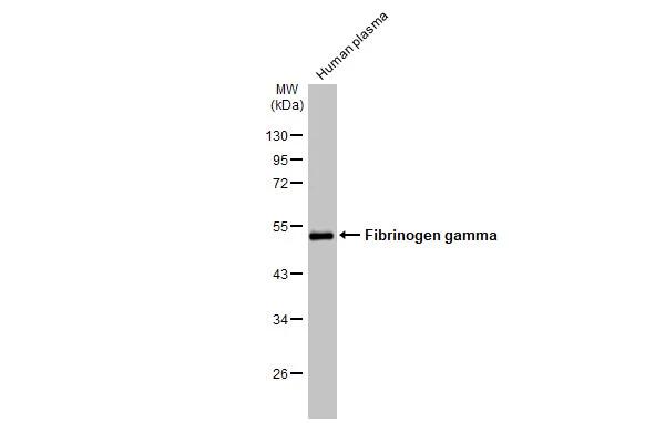 Human plasma (30 �g) was separated by 10% SDS-PAGE, and the membrane was blotted with Fibrinogen gamma chain antibody (NBP1-31766) diluted at 1:2000. The HRP-conjugated anti-rabbit IgG antibody was used to detect the primary antibody. 