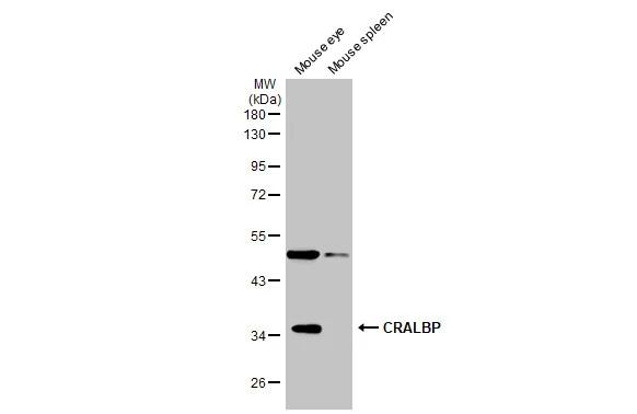 Various tissue extracts (50 ug) were separated by 10% SDS-PAGE, and the membrane was blotted with CRALBP antibody [N2C3] (NBP1-31770) diluted at 1:1000. The HRP-conjugated anti-rabbit IgG antibody was used to detect the primary antibody. 