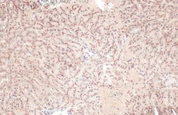 Immunohistochemistry-Paraffin: ABCB11 Antibody [NBP1-31824] - ABCB11 antibody [N3C1], Internal detects ABCB11 protein at cell membrane by immunohistochemical analysis.Sample: Paraffin-embedded mouse liver.ABCB11 stained by ABCB11 antibody [N3C1], Internal (NBP1-31824) diluted at 1:500.Antigen Retrieval: Citrate buffer, pH 6.0, 15 min