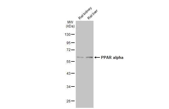 Various tissue extracts (50 �g) were separated by 10% SDS-PAGE, and the membrane was blotted with PPAR alpha/NR1C1 antibody (NBP1-31834) diluted at 1:2000. The HRP-conjugated anti-rabbit IgG antibody was used to detect the primary antibody. 