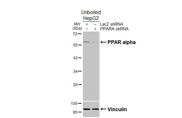 <b>Genetic Strategies Validation and Orthogonal Strategies Validation.</b>Non-transfected (�) and transfected (+) unboiled HepG2 whole cell extracts (30 �g) were separated by 10% SDS-PAGE, and the membrane was blotted with PPAR alpha/NR1C1 antibody (NBP1-31834) diluted at 1:1000. The HRP-conjugated anti-rabbit IgG antibody was used to detect the primary antibody. 