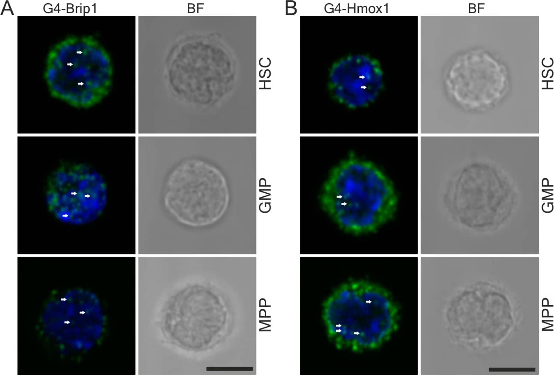 Immunocytochemistry/ Immunofluorescence: BRIP1/FANCJ Antibody [NBP1-31883] - Detection of the PLA signal in sorted hematopoietic stem cells. (A) G4–Brip1 & (B) G4–Hmox1 interactions (green dots) were visualized in HSCs & GMP & MPP cells. G4 interactions were visible in the nucleus (arrows) & in the cytoplasm. Nuclei were counterstained with DAPI (blue), where the transmission bright-field images (BF) show the cell morphologies. Cells were fixed in PFA & goat 1H6 antibodies were used. Scale bars: 5 μm. Image collected & cropped by CiteAb from the following publication (//pubmed.ncbi.nlm.nih.gov/33445471), licensed under a CC-BY license. Not internally tested by Novus Biologicals.