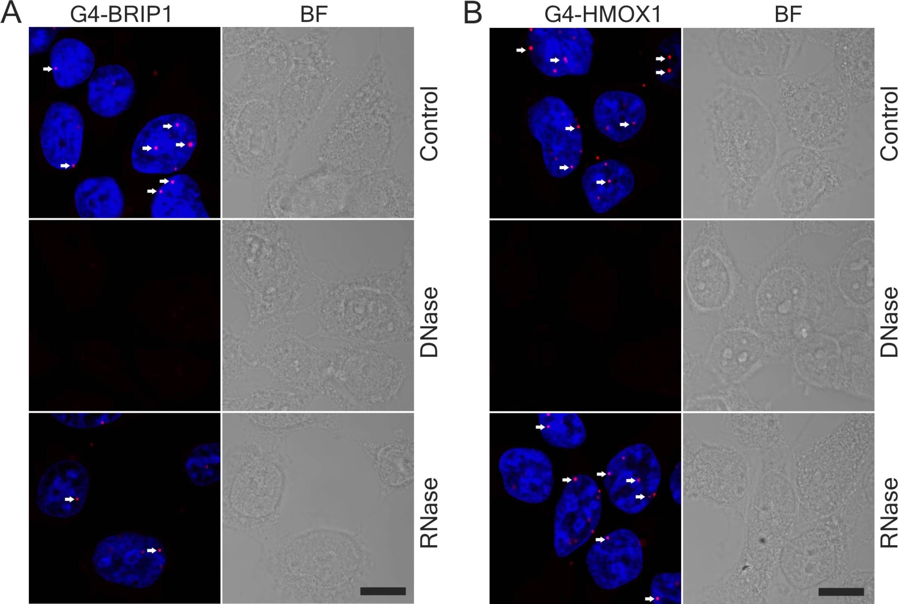 Immunocytochemistry/ Immunofluorescence: BRIP1/FANCJ Antibody [NBP1-31883] - In situ proximity ligation assay (PLA) in HEK293T cells. (A) G4-BRIP1 & (B) G4-HMOX1 interactions (red dots) were visualized in the control group & after DNase or RNase digestion. Most of the G4 interactions were localized in the nucleus (arrows), but some were also present in the cytoplasm. Cells that were fixed in methanol & mouse 1H6 antibodies were used. Nuclei were counterstained with DAPI (blue), where the transmission bright-field images (BF) show the cell morphologies. Scale bar: 10 μm. Image collected & cropped by CiteAb from the following publication (//pubmed.ncbi.nlm.nih.gov/33445471), licensed under a CC-BY license. Not internally tested by Novus Biologicals.