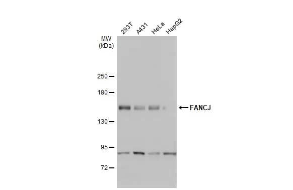 Western Blot: BRIP1/FANCJ Antibody [NBP1-31883] - Various whole cell extracts (30 ug) were separated by 5% SDS-PAGE, and the membrane was blotted with BRIP1/FANCJ antibody [N1N2], N-term (NBP1-31883) diluted at 1:1000. The HRP-conjugated anti-rabbit IgG antibody  was used to detect the primary antibody.