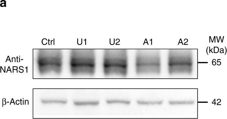 Patients cells display loss of NARS1 functions.a Fibroblast cells from two unaffected (U1 and U2) and two affected (A1 and A2) show reduced levels compared with actin control. b Quantification results for WB, n = 3, Error bar: +/- SD. c Overexpression in cDNA expressing patient variants in HEK293T cells showed unstable NARS1 protein. d Reduced NARS1 tRNA synthetase activity in patient fibroblasts. n = 3, Error bar: +/- SD. e Other tRNA-ARS activity not impaired in NARS1 mutated cells. TARS: Threonyl-tRNA synthetase; KARS: lysyl-tRNA synthetase; RARS: arginyl-tRNA synthetase. n = 3, Error bar: +/- SD. f Patient IPSCs showed reduced puromycin incorporation after 1 h pulse, indicating reduced protein synthesis. For the quantification data in (b) and (d), n = 3 represents three independent biological replicates, two-tailed p values based upon Student t-test with Holm–Šidak multiple comparison correction, and individual p value was shown in (b, d); Source data are provided as a Source Data file. Image collected and cropped by CiteAb from the following open publication (//pubmed.ncbi.nlm.nih.gov/32788587), licensed under a CC-BY license. Not internally tested by Novus Biologicals.