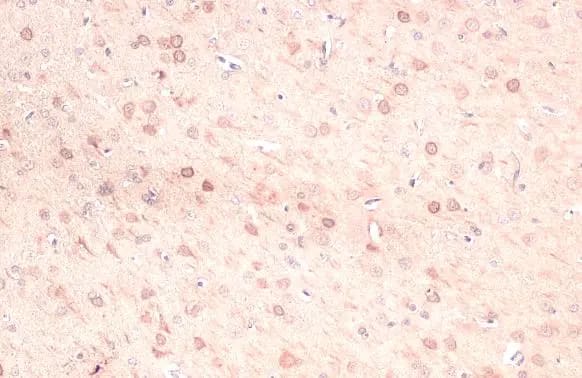 Immunohistochemistry-Paraffin: Ferritin Heavy Chain Antibody [NBP1-31944] - Ferritin Heavy Chain antibody [N1C3] detects Ferritin Heavy Chain protein at cytoplasm by immunohistochemical analysis.Sample: Paraffin-embedded rat brain.Ferritin Heavy Chain stained by Ferritin Heavy Chain antibody [N1C3] (NBP1-31944) diluted at 1:500.Antigen Retrieval: Citrate buffer, pH 6.0, 15 min