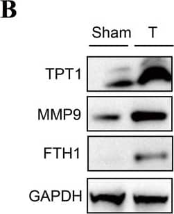 Verification of the expression level of TPT1, MMP9, and FTH1.(A) qPCR results of the three genes. (B) Western blot of the three proteins. **p < 0.01. Image collected and cropped by CiteAb from the following open publication (//pubmed.ncbi.nlm.nih.gov/38025678), licensed under a CC-BY license. Not internally tested by Novus Biologicals.