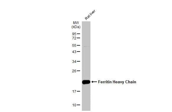 Rat tissue extract (50 ug) was separated by 12% SDS-PAGE, and the membrane was blotted with Ferritin Heavy Chain antibody [N1C3] (NBP1-31944) diluted at 1:500. The HRP-conjugated anti-rabbit IgG antibody was used to detect the primary antibody. 