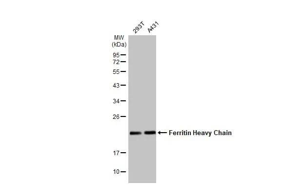 Various whole cell extracts (30 ug) were separated by 12% SDS-PAGE, and the membrane was blotted with Ferritin Heavy Chain antibody [N1C3] (NBP1-31944) diluted at 1:1000. The HRP-conjugated anti-rabbit IgG antibody was used to detect the primary antibody. 