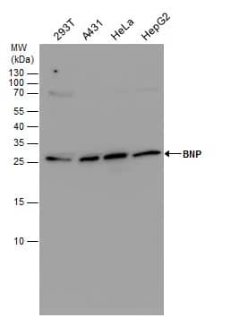 Western Blot: BNP Antibody [NBP1-32038] - BNP antibody detects BNP  protein by Western blot analysis. Various whole cell extracts (30 ug) were separated by 15% SDS-PAGE, and the membrane was blotted with BNP antibody (NBP1-32038) diluted by 1:1000.