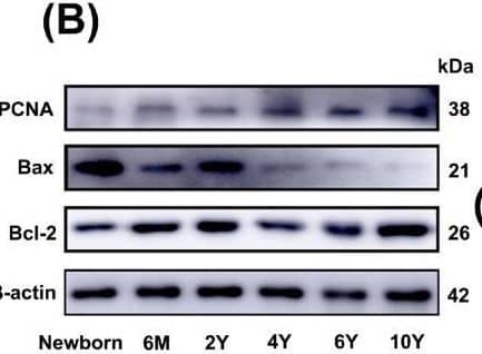 IHC, Western blot, and qRT-PCR analysis of changes in PCNA, Bax, and Bcl-2 in heart tissue of yak at different stages. (A) Localization and distribution of PCNA, Bax, and Bcl-2 proteins in yak hearts at different ages. Magnification: ×20, Bar = 100 μm. (B,C) The levels of PCNA, Bax, and Bcl-2 proteins in heart tissue of yaks at different ages were determined by Western blot. Western blot original images can be found in File S1. (D) The levels of PCNA, Bax, and Bcl-2 mRNAs in heart tissues of yaks at different ages were determined by qRT-PCR. (nsp ≥ 0.05, * p < 0.05, ** p < 0.01) (n = 3). ★: cardiomyocytes; ▲: vascular smooth muscle cells; ↑: vascular endothelial cells. Newborn: Newborn; 6 M: 6 months old; 2 Y: 2 years old; 4 Y: 4 years old; 6 Y: 6 years old; 10 Y: 10 years old. Image collected and cropped by CiteAb from the following open publication (//pubmed.ncbi.nlm.nih.gov/40001559), licensed under a CC-BY license. Not internally tested by Novus Biologicals.