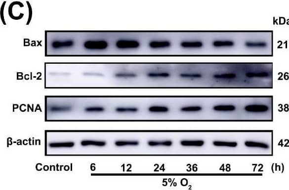 Hypoxia induces the expression of PCNA, Bax, and Bcl-2 in yak CASMCs. (A) Primary yak CASMCs were cultured in vitro. Magnification: ×10, Bar = 200 μm. (B) Identification of CASMCs in yak heart. Magnification: ×10, Bar = 200 μm. (C,D) Hypoxia-induced levels of PCNA, Bax, and Bcl-2 proteins in CASMCs of yak heart induced by Western blot. (E) Hypoxia-induced levels of PCNA, Bax, and Bcl-2 mRNAs in CASMCs of yak heart by qRT-PCR. (nsp ≥ 0.05, * p < 0.05, ** p < 0.01) (n = 3). Image collected and cropped by CiteAb from the following open publication (//pubmed.ncbi.nlm.nih.gov/40001559), licensed under a CC-BY license. Not internally tested by Novus Biologicals.