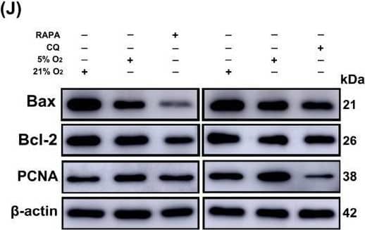 Activation (RAPA) (20 μM) and inhibition (CQ) (50 μM) of HIF-1 alpha  affected autophagy, proliferation, and anti-apoptosis ability of yak heart CASMCs. (A–C) Effects of RAPA and CQ on the expression of autophagy-related proteins in yak heart CASMCs. (D–G) RAPA and CQ on the expression of LC3-II and P62 protein in yak heart CASMCs by IF analysis. Magnification: ×10, Bar = 200 μm. (H,I) The effects of RAPA and CQ on autophagy expression in yak heart CASMCs by Ad-mRFP-GFP-LC3B analysis. Bar = 20 μm. (J–L) The effects of RAPA and CQ on the expression of proliferation- and apoptosis-related proteins in yak heart CASMCs by Western blot. (M,O) EdU proliferation was used to detect the effect of RAPA and CQ on proliferation expression in yak heart CASMCs. (N,P) Tunel apoptosis was used to detect the effect of RAPA and CQ on apoptosis expression in yak heart CASMCs. Magnification: ×10, Bar = 200 μm. (** p < 0.01) (n = 3). Image collected and cropped by CiteAb from the following open publication (//pubmed.ncbi.nlm.nih.gov/40001559), licensed under a CC-BY license. Not internally tested by Novus Biologicals.