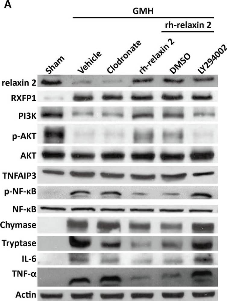Knockdown of RXFP1 (a, c, l) by specific siRNA significantly inhibited the expression of PI3K (a, d), phosphorylated Akt (a, e), and TNFAIP3 (a, f) on the first day after intracerebroventricular injections. However, the expression of phosphorylated NF-kappa B (a, g) and inflammatory factors chymase (a, h), tryptase (a, i), IL-6 (a, j), and TNF-alpha  (a, k) increased on the first day after GMH. *P  0.05, GMH + vehicle vs. LY294002; $P < 0.05, DMSO vs. LY294002, one-way ANOVA, Tukey’s test, n = 6 Image collected and cropped by CiteAb from the following open publication (//pubmed.ncbi.nlm.nih.gov/32859236), licensed under a CC-BY license. Not internally tested by Novus Biologicals.