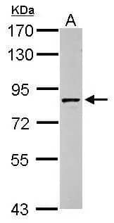 Western Blot: Granulin Antibody [NBP1-32076] - Sample (30 ug of whole cell lysate)  A: HepG2  7.5% SDS PAGE  NBP1-32076 diluted at 1:1000 The HRP-conjugated anti-rabbit IgG antibody  was used to detect the primary antibody.