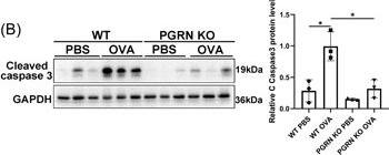 Deletion of progranulin suppressed apoptosis in the airways exposed to ovalbumin, but aggravated the human bronchial epithelial cells apoptosis in vitro. (A) Representative images of lung sections from WT and PGRN KO mice stained for TUNEL. Scale bar: 100 μm. (B) The protein levels of cleaved caspase 3 in mice lung were analyzed by Western blot. The results of densitometric analysis were showed as means +/- SD (n = 3). *p < .05, unpaired t test. (C) Western blot analysis of PGRN and cleaved caspase 3 in 16‐HBE cells treated (or not) with H2O2 for 48 h. The results of densitometric analysis were showed as means +/- SD (n = 3). ****p < .0001, one‐way ANOVA. (D) The knockdown efficiency of siRNA targeting PGRN was identified at the mRNA and protein levels 24 and 48 h following transfection, respectively. The relative mRNA expression and densitometric analysis were showed as means +/- SD (n = 3). ****p < .0001, one‐way ANOVA. (E) Following knockdown of PGRN for 24 h, 16‐HBE cells were treated (or not) with H2O2 for 24 h. The densitometric analysis of cleaved caspase 3 was presented as means +/- SD (n = 3). *p < .05, unpaired t test. The study was repeated for three times. ANOVA, analysis of variance; DAPI, 4′,6‐diamidino‐2‐phenylindole; HBE, human bronchial epithelial cells; TUNEL, terminal deoxynucleotidyl transferase dUTP nick end labeling. Image collected and cropped by CiteAb from the following open publication (//pubmed.ncbi.nlm.nih.gov/36840485), licensed under a CC-BY license. Not internally tested by Novus Biologicals.
