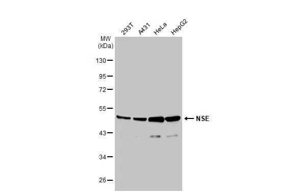 Western Blot: Enolase 2/Neuron-specific Enolase Antibody [NBP1-32090] - Various whole cell extracts (30 ug) were separated by 10% SDS-PAGE, and the membrane was blotted with Enolase 2/Neuron-specific Enolase antibody [N1C1] (NBP1-32090) diluted at 1:2000. The HRP-conjugated anti-rabbit IgG antibody  was used to detect the primary antibody.