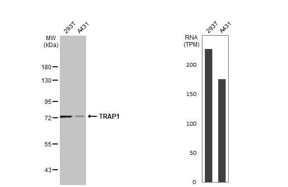 <b>Orthogonal Strategies Validation. </b>Various whole cell extracts (30 ug) were separated by 7.5% SDS-PAGE, and the membrane was blotted with TRAP1 antibody (NBP1-32097) diluted at 1:1000. The HRP-conjugated anti-rabbit IgG antibody was used to detect the primary antibody. Corresponding RNA expression data for the same cell lines are based on Human Protein Atlas program. 