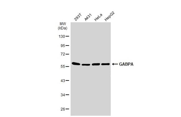 Western Blot: GABPA Antibody [NBP1-32105] - Various whole cell extracts (30 ug) were separated by 10% SDS-PAGE, and the membrane was blotted with GABPA antibody [N2C2], Internal (NBP1-32105) diluted at 1:1000. The HRP-conjugated anti-rabbit IgG antibody  was used to detect the primary antibody.