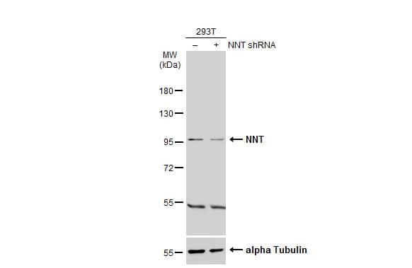 Western Blot: NNT Antibody [NBP1-32109] - Non-transfected (–) and transfected (+) 293T whole cell extracts (30 ug) were separated by 7.5% SDS-PAGE, and the membrane was blotted with NNT antibody  diluted at 1:500. The HRP-conjugated anti-rabbit IgG antibody  was used to detect the primary antibody.