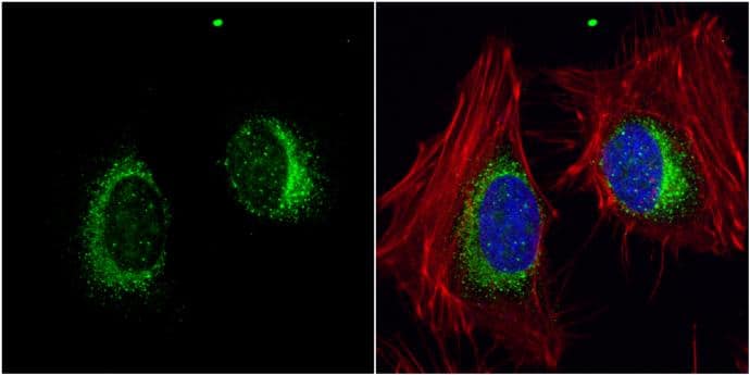 ORP150/HSP12A antibody [C2C3], C-term detects ORP150/HSP12A protein at endoplasmic reticulum by immunofluorescent analysis.Sample: HeLa cells were fixed in 4% paraformaldehyde at RT for 15 min.Green: ORP150/HSP12A protein stained by ORP150/HSP12A antibody [C2C3], C-term (NBP1-32140) diluted at 1:200.Red: phalloidin, a cytoskeleton marker, stained by phalloidin (invitrogen, A12380) diluted at 1:200.Blue: Hoechst 33342 staining. 
