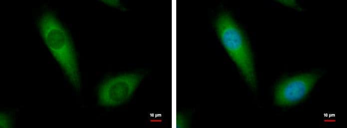 NDUFA10 antibody [N1C3] detects NDUFA10 protein at cytoplasm by immunofluorescent analysis.Sample: HeLa cells were fixed in 2% paraformaldehyde/culture medium at 37C for 30 min.Green: NDUFA10 protein stained by NDUFA10 antibody [N1C3] (NBP1-32146) diluted at 1:500.Blue: Hoechst 33342 staining. 