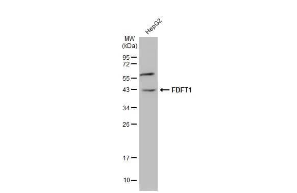 Western Blot: FDFT1 Antibody [NBP1-32147] - Whole cell extract (30 ug) was separated by 12% SDS-PAGE, and the membrane was blotted with FDFT1 antibody [N2C3] (NBP1-32147) diluted at 1:1500. The HRP-conjugated anti-rabbit IgG antibody  was used to detect the primary antibody.