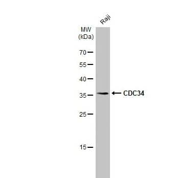 UbcH3/Cdc34 Antibody [NBP1-32153] -Whole cell extract (30 ug) was separated by 12% SDS-PAGE, and the membrane was blotted with CDC34 antibody [N1C3] diluted at 1:1000. The HRP-conjugated anti-rabbit IgG antibody (NBP2-19301) was used to detect the primary antibody.