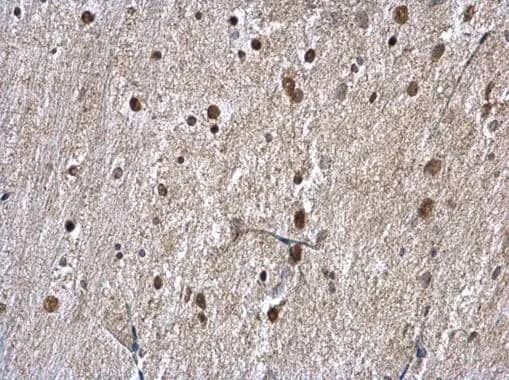 Immunohistochemistry: hnRNP A1 Antibody [NBP1-32161] - hnRNP A1 antibody detects hnRNP A1 protein at nucleus on mouse heart by immunohistochemical analysis. Sample: Paraffin-embedded mouse heart. hnRNP A1 antibody (NBP1-32161) diluted at 1:500.Antigen Retrieval: Trilogy™ (EDTA based, pH 8.0) buffer, 15min