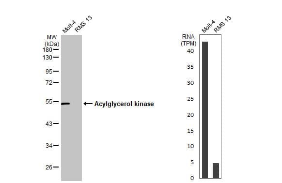 Western Blot: Acylglycerol Kinase Antibody [NBP1-32163] - Various whole cell extracts (30 ug) were separated by 10% SDS-PAGE, and the membrane was blotted with Acylglycerol kinase antibody  diluted at 1:500. The HRP-conjugated anti-rabbit IgG antibody  was used to detect the primary antibody.